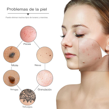 PLASMAPEN® | Tu piel libre de verrugas, lunares y manchas